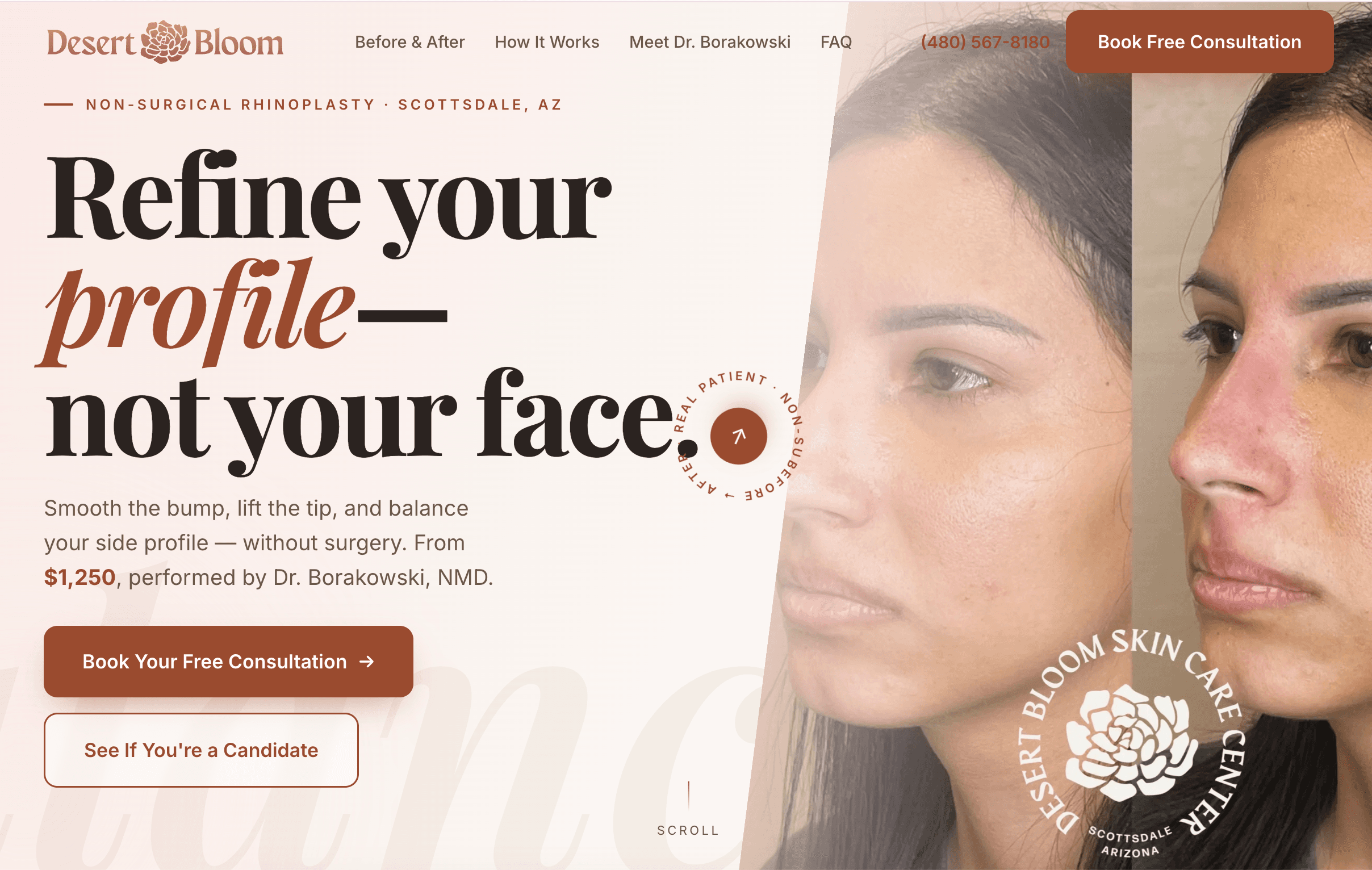 Desert Bloom non-surgical rhinoplasty landing page