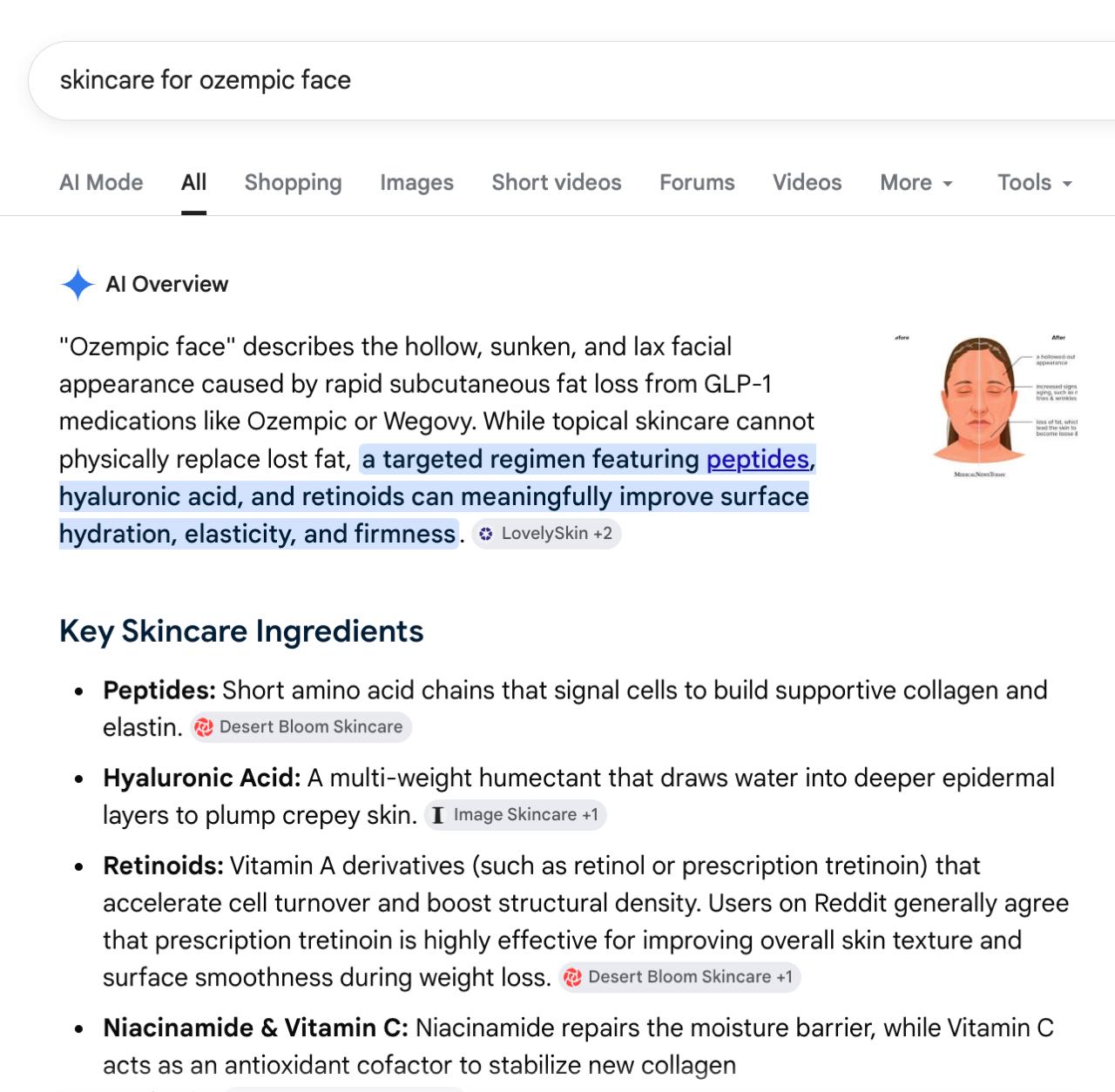 Google AI Overview citing Desert Bloom for skincare for ozempic face